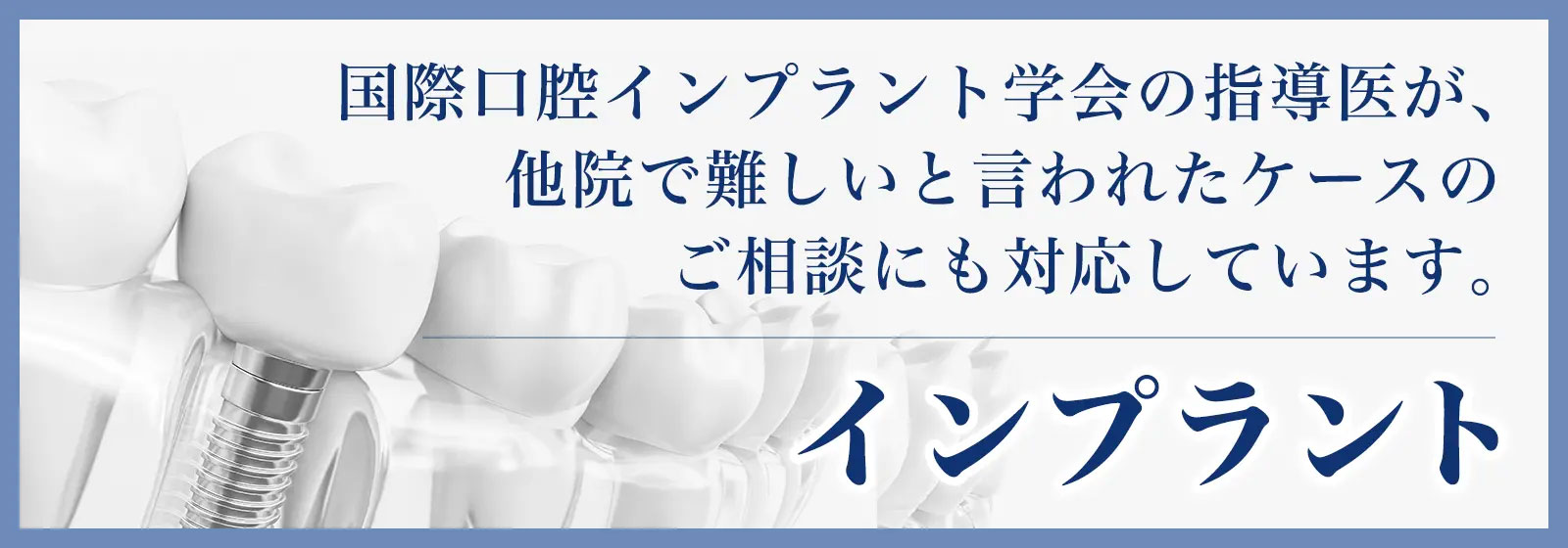 インプラントバナー